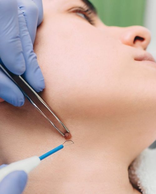 SSUCv3H4sIAAAAAAAEAJ2Sy27DIBBF95X6DxbrINmAX/2VqosxTGJUAhHGraIo/97xK2LdHXPmwZ0Lj/e3omADTFazj+KxRBRb5+YpRUg2eMLlaecRvcGYEzQ2hWjB5XCApEcPVyToZ+cW/FyTbEqQ5gmn5bIdaUh4oRkbfI3YFH1ucXEk1iR1UIqxU8ameVjZgZ6nf3duh69jG7ig1/dVcLZIRIewLbJrZDX2ApTRvKo74KoTHYcOBl4OpVB1qVrQLXtNlboVRpZ8ENhQ8ZmKpax5rVqUBvryLHGVtOlg378J4zX3DWZjQ2bZT9DglgKZybxFq62/ZG0hjesTHm06zD7Fe24LcyHcYHDL+51pJh58hGmicnPw7CJNHyZcs3t8SKs7+1Rm6JmXsJJV38hGqL4nS6RQkh1fI+hva/IVt98yWkrFe8btooCJupVGKsMHU1ZckWPkd9fzFrsOQQnTtIIsfP4BR7FL0uQCAAA=